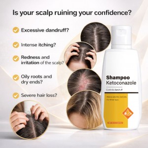 Ready to Ship Ketoconazole Anti-Dandruff Shampoo – Medicated 2% Formula for Seborrheic Dermatitis, Targeted Relief from Scalp Flaking, Itching & Fungal Overgrowth, Clinically Proven Dandruff Treatment