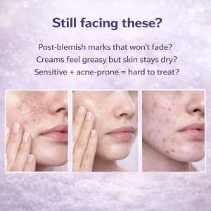 Ready to Ship Expert Madeca In Cream – Skin Barrier Restart Formula， 48H Deep Hydration & Redness Relief in 15 Mins， Fast-Acting Soothing Moisturizer for Sensitive & Damaged Skin