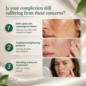 Ready to Ship Dark Spot Correcting Glow Cream – Advanced Brightening Formula for Hyperpigmentation， Sun Spots & Acne Marks， Illuminating Moisturizer for Even Skin Tone & Radiant Glow