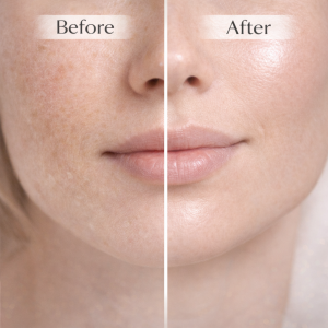 Ready to Ship GHK-Cu Whipped Tallow Honey Balm – Triple-Action Skin Repair Formula with Copper Peptide, Grass-Fed Tallow & Manuka Honey, Deeply Nourishing Multi-Purpose Balm for Face, Body, Lips, Sensitive & Damaged Skin